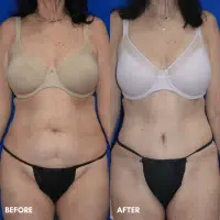 OLD FMPS B&A Template - TT w/ flank lipo OLD FMPS B&A Template - TT w/ flank lipo