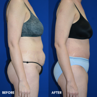 FMPS B&A Template - TT
