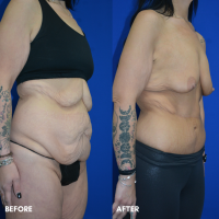 FMPS B&A Template - TT