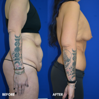 FMPS B&A Template - TT