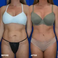 OLD FMPS B&A Template- Sanderson & Braswell Patients - TT- Braswell OLD FMPS B&A Template- Sanderson & Braswell Patients - TT- Braswell