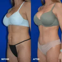 OLD FMPS B&A Template- Sanderson & Braswell Patients - TT- Braswell (2) OLD FMPS B&A Template- Sanderson & Braswell Patients - TT- Braswell (2)