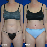 FMPS B&A Template - TT