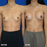 FMPS B&A Template - BBA