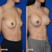 FMPS B&A Template - 92
