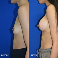 FMPS B&A Template - BBA