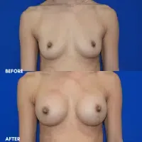 OLD FMPS B&A Template - Front BBA