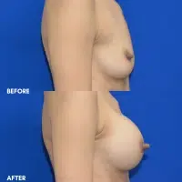 OLD FMPS B&A Template - Side BBA