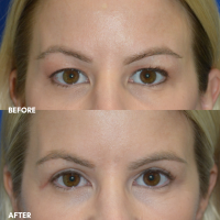 FMPS B&A Template - IA